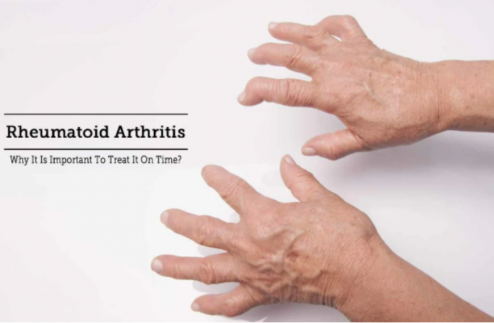 Ayurvedic approach to Rheumatoid Arthritis Treatment